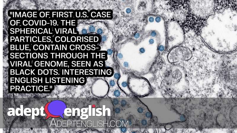 Image of first U.S. case of COVID-19. The spherical viral particles, colorised blue, contain cross-sections through the viral genome, seen as black dots. Interesting English listening practice.